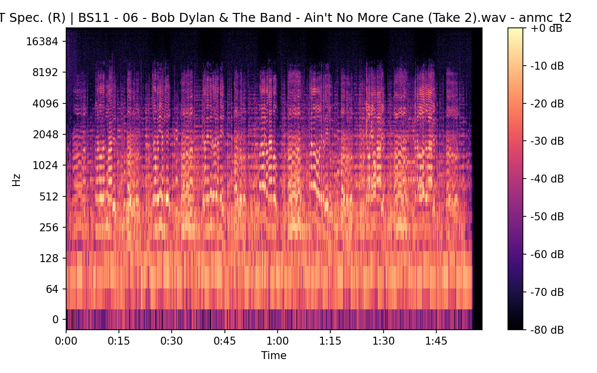 STFT Spectrogram (Right)