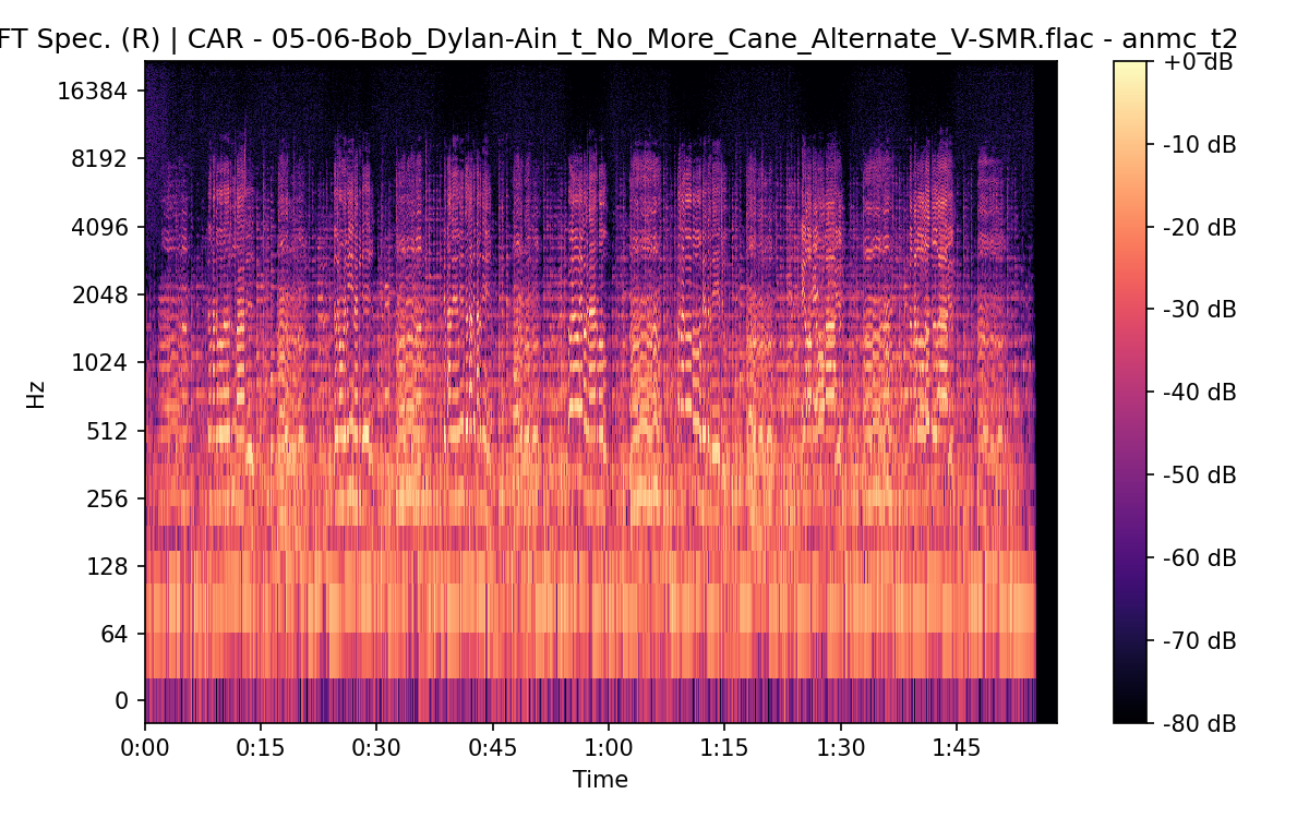 STFT Spectrogram (Right)
