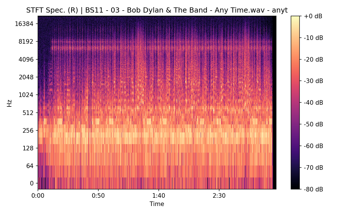 STFT Spectrogram (Right)