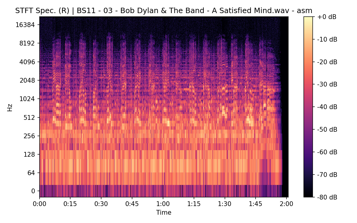 STFT Spectrogram (Right)