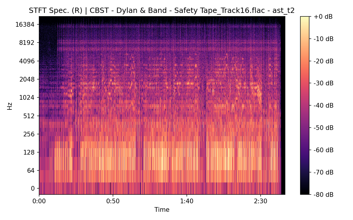 STFT Spectrogram (Right)