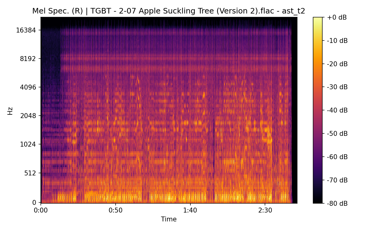 Mel Spectrogram (Right)