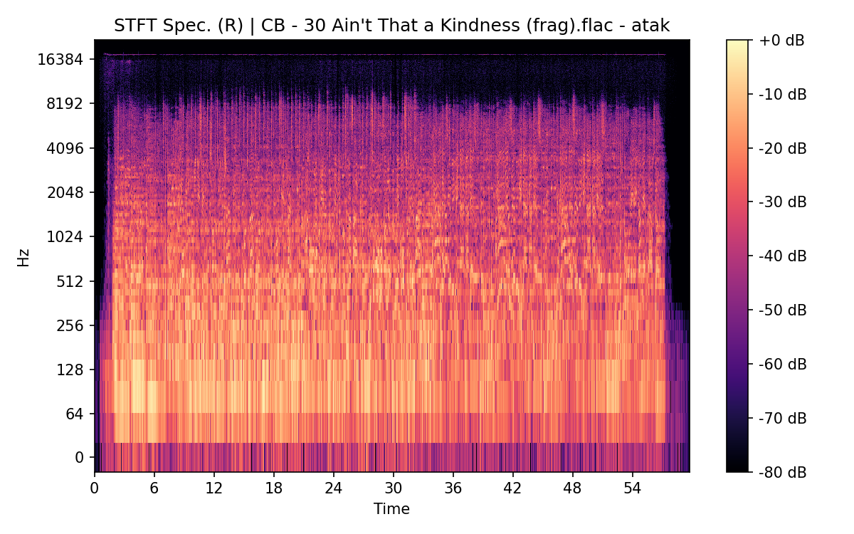 STFT Spectrogram (Right)
