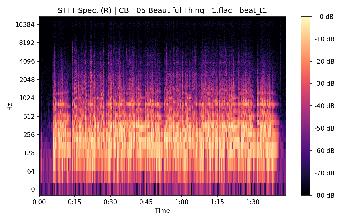 STFT Spectrogram (Right)