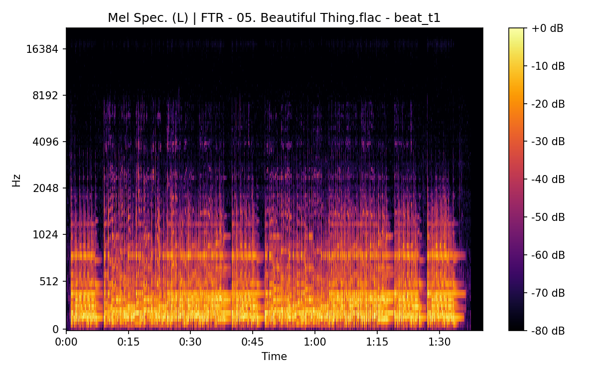 Mel Spectrogram (Left)