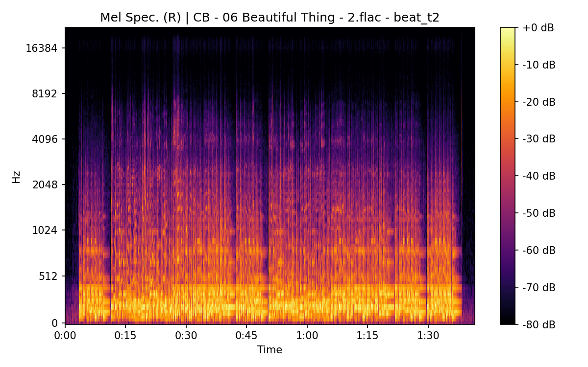 Mel Spectrogram (Right)