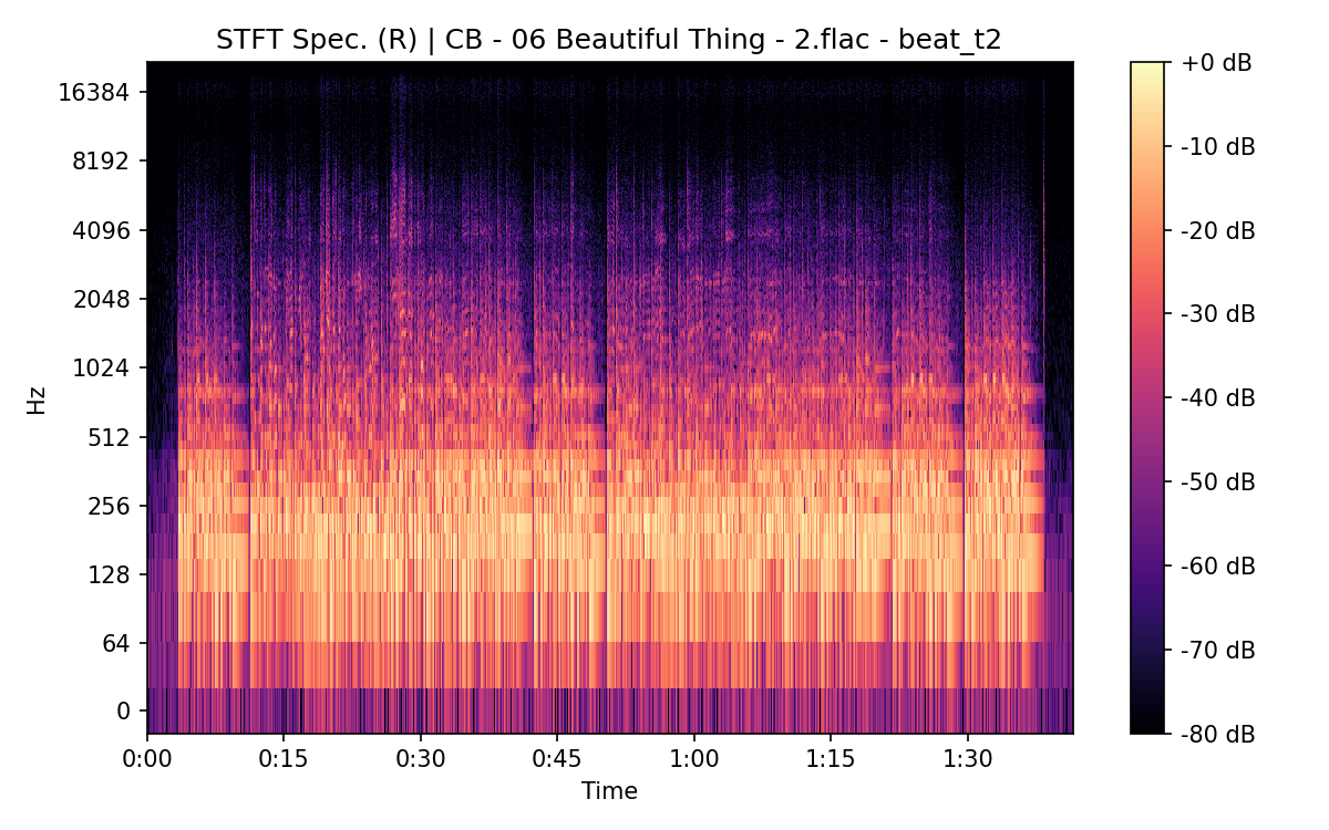 STFT Spectrogram (Right)