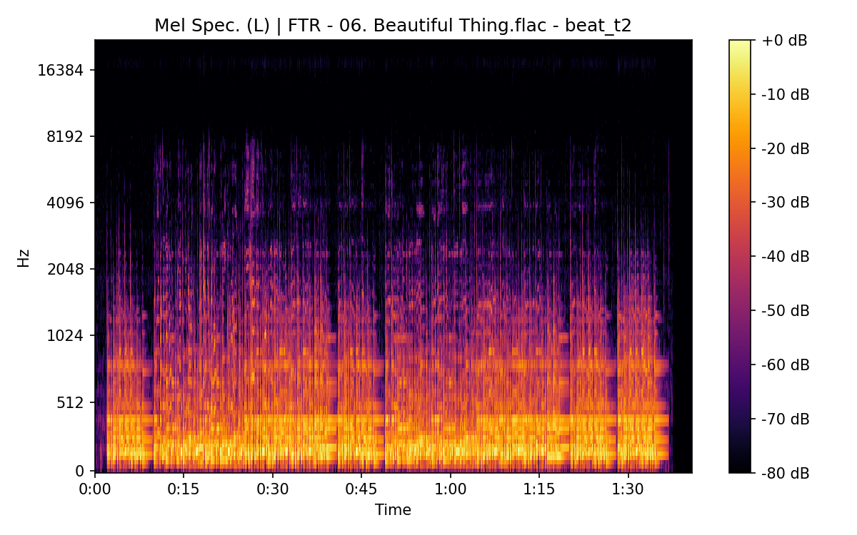 Mel Spectrogram (Left)