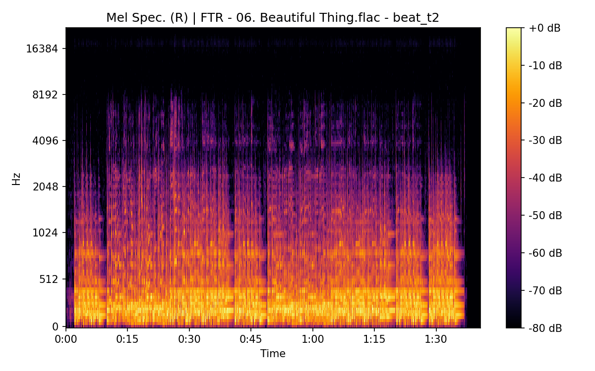 Mel Spectrogram (Right)