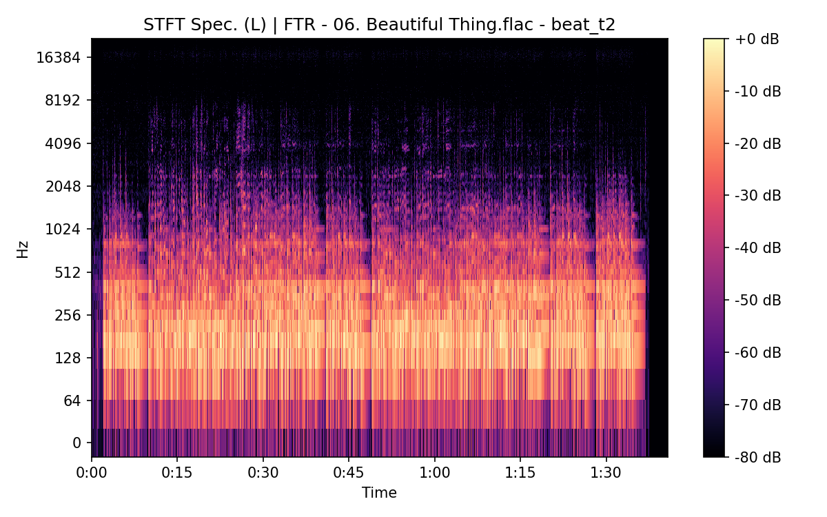 STFT Spectrogram (Left)