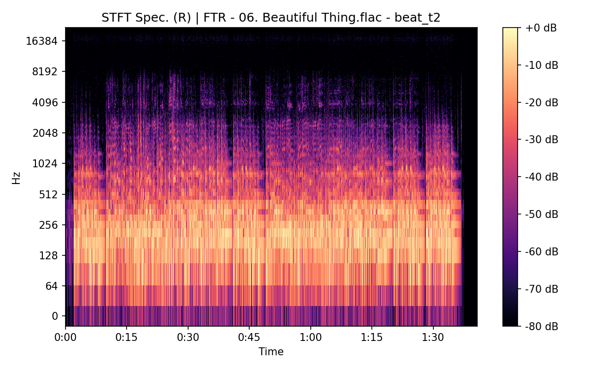 STFT Spectrogram (Right)