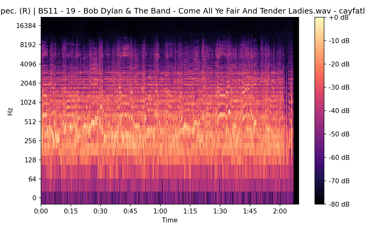 STFT Spectrogram (Right)