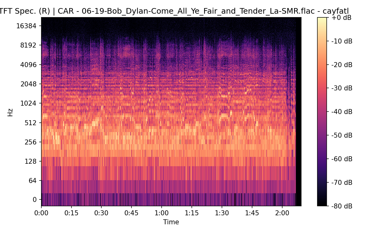 STFT Spectrogram (Right)