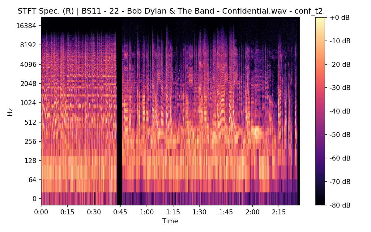 STFT Spectrogram (Right)