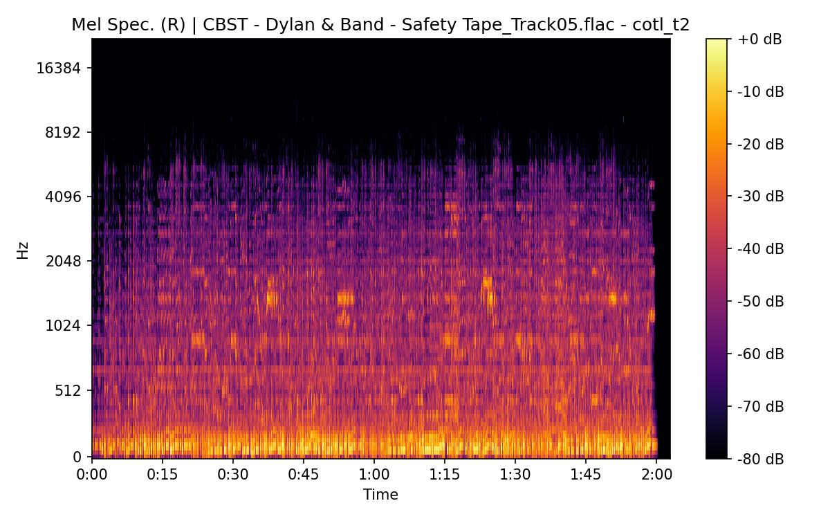 Mel Spectrogram (Right)