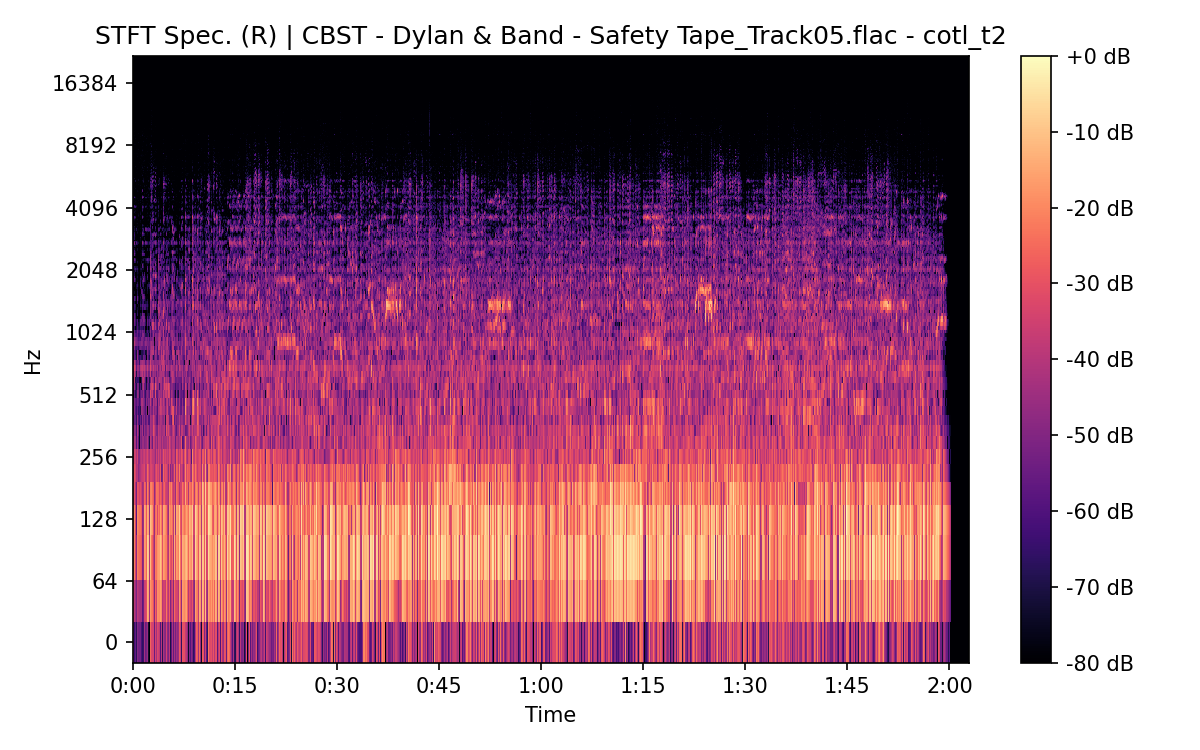 STFT Spectrogram (Right)